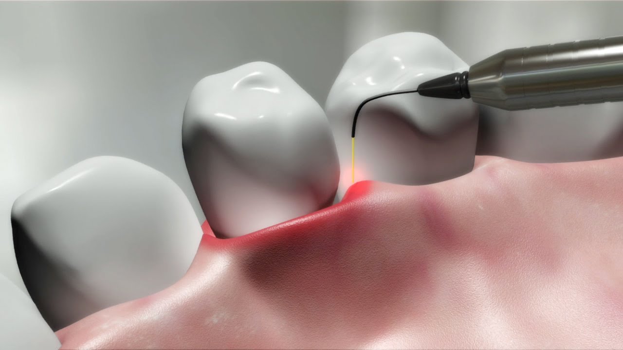 Teknologi Di Dunia Kedokteran Gigi
