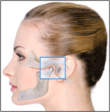 tmj jaw-joint