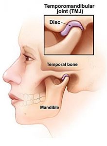 jaw joint and earache