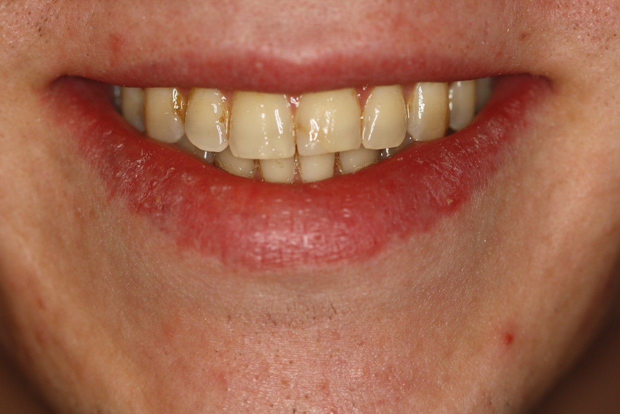Picture11