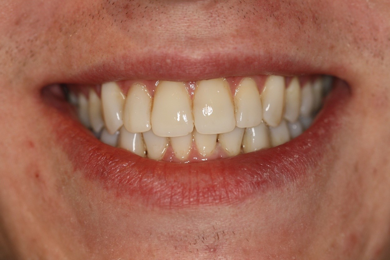 Picture12