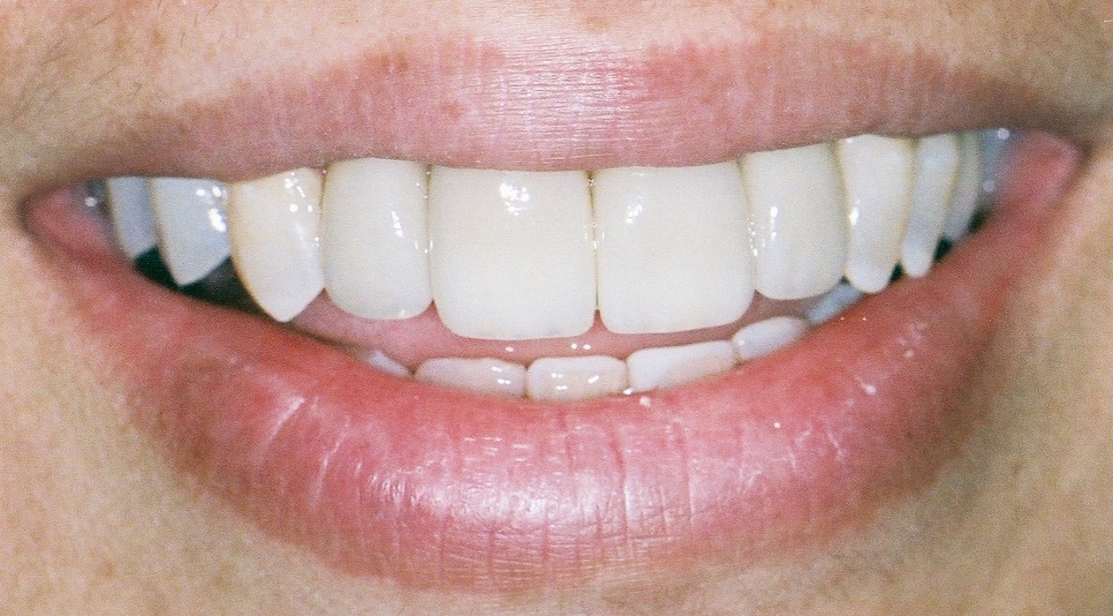 Picture24