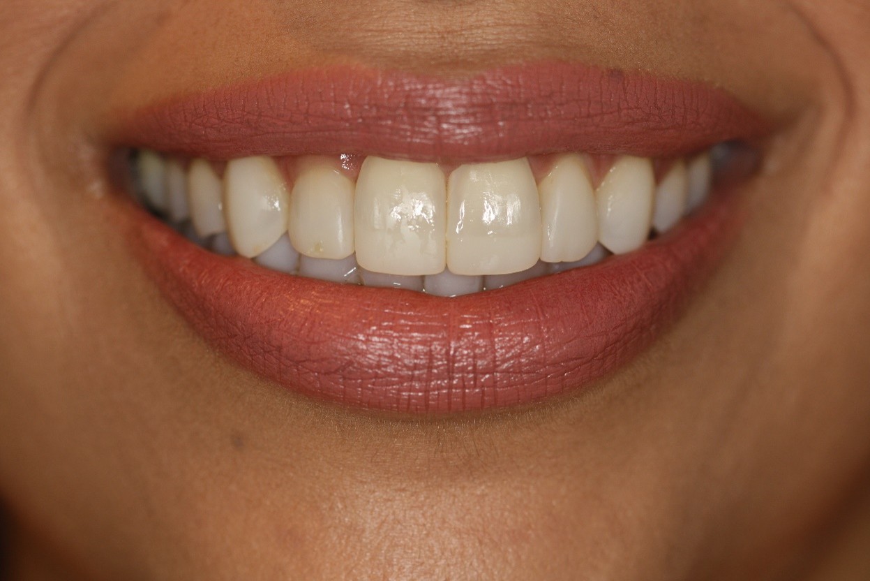 Picture30
