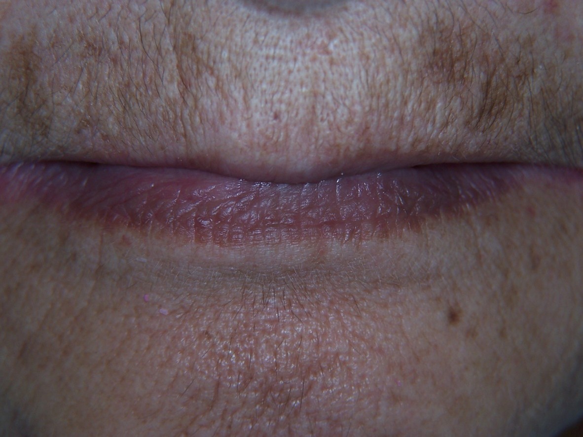 Picture47