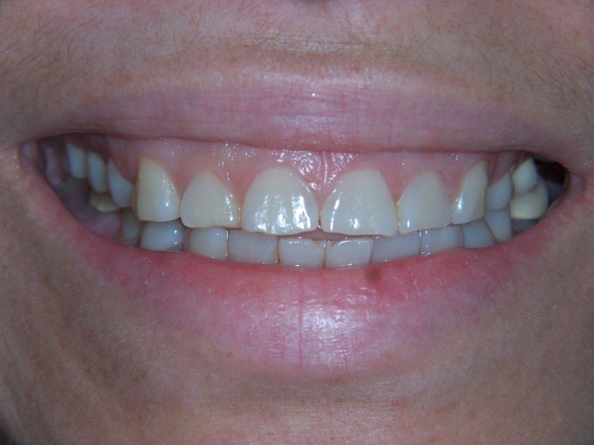Picture9